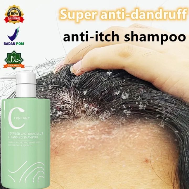 shampo anti ketombe 500ml Sampo buat ketombe Shampoo penghilang ketombe