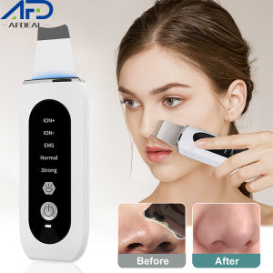 Afdeal Ultrasonic Skin Scrubber Skin Care Machine Skin Massager Blackhead Remover Pore Cleaner EMS LED Peeling Shovel Cleaner