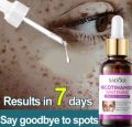 SADOER Freckle Serum Cream Remove Dark Spots on Face Melasma and Pekas Remover Original Pekas Remover Cream Original Dark Spot Remover Retinol Cream Original for Melasma Remover Anti Melasma Remover Cream Freckle Cream Whitening Facial Skin Care Cream. 