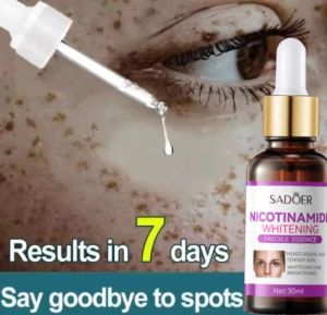 SADOER Freckle Serum Cream Remove Dark Spots on Face Melasma and Pekas Remover Original Pekas Remover Cream Original Dark Spot Remover Retinol Cream Original for Melasma Remover Anti Melasma Remover Cream Freckle Cream Whitening Facial Skin Care Cream
