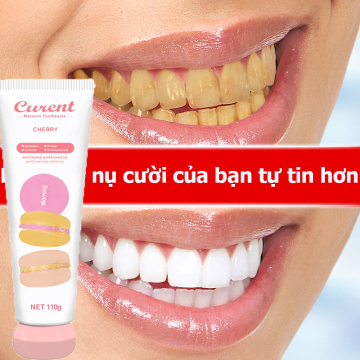 Kem đánh răng trẻ emTẩy trắng răng kem đánh răng Kem đánh răng vi sinh ...