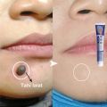 Obat Kutil Paling Ampuh Wart Remover Krim Penghilang Kutil Salep Kutil Penghilang Kutil Wajah Menghilangkan Kutil Filiform. 