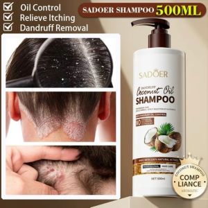 [BUY 1 TAKE 1]Coconut Oil Moisturizing Hair Care Dandruff Shampoo Refreshing Oil Control 500ml