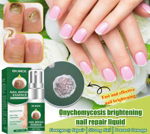 Toenail Repair Serum/Toenail Care Liquid/Anti-inflammatory Toenail Serum/Brightening Long-lasting Care/Home Use Foot Care