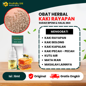 Obat Kaki Rayapan dan Bau Penghilang Kaki Rayapan Telapak Kaki Bolong Bolong Kapalan Tumit Kering Kasar Kaki Pecah Pecah Mata Ikan - Propolis Sm Brazil Original