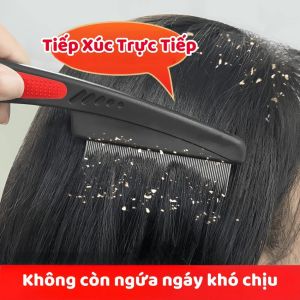 Lược Chải Gàu Inox Răng Khít – Làm Sạch Sâu Da Đầu Giảm Ngứa Giảm Bết Giữ Tóc Sạch Lâu