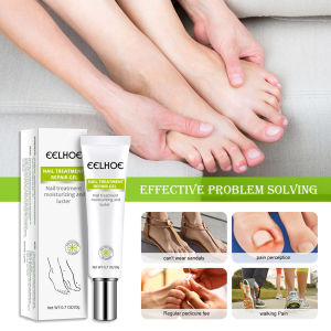 Eelhoe Nail Repair Gel Moisturizing And Luster Onychomycosis Repair Essence Cream Toe Nail Fungus Gel Manicure Care Tool Effective(20g)