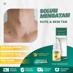 Obat Penghilang Skin Tag Obat Untuk Kutil Di Wajah Obat Kutil Di Leher Obat Perontok Kutil Wajah Kutil Papiloma Pengempis Papiloma Daging Tumbuh di Wajah Dengan Propolis SM