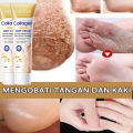 krim kaki pecah dan kering collagen Foot cream kaki pecah Pelembab kaki kering dan pecah Penghalus kaki kasar dan pecah Ultra Pelembab Obat Tumit Kaki Dan Tangan Kering Cream Tumit Kaki Pecah Dan Kering Salep Penghilang Pecah Pecah Di Kaki. 
