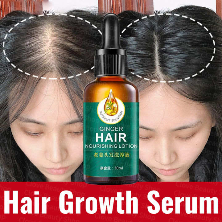 100% natural ginger Hair Serum Hair Grower Fast Long Hair Hair ...