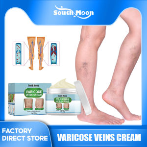 South Moon Natural Herbs Effective Varicose Veins Treatment Cream Spider Veins Cream Health Care Ointment Varicose Veins Cream Varicose Vein Removal Natural Treatment Spider Veins Cream Effective Original Varicose Veins Remover For Legs Veins Care