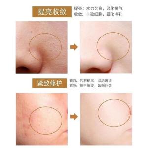 Omelin Dragon blood cream repair facial moisturizing dragon blood essence