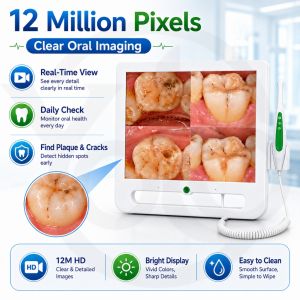Digital Endoscope Intraoral Camera Dental 17 Inch Lcd Monitor 16mp All-In-One Oral Intraoral Camera