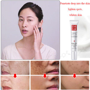 Lan Di Ruomu Whitening and Spot-Removing Cream (Fuyan) 20g for Clearer Skin