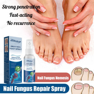 Grey Nail Repair Spray/Nail Fungus Repair Spray Onyhomyosis Care Spray