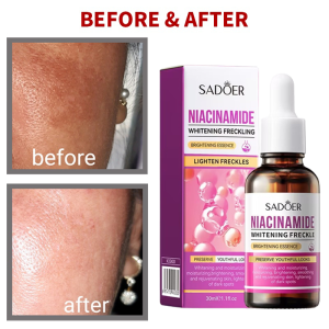 Facial Essence Serum Skincare Anti Aging Wrinkle Control Anti-oxidation Liquid Nicotinamide Whitening 30ml Brightening skin Moisturizing Whitening Essence