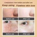 30g Whitening melasma cream Freckle Removing Cream pekas cream original japan  Remove Wrinkles Cream Pekas Remover Cream Blemish Cream Remove Melasma Freckles Anti Aging Serum Sunburn remove dark spot on face pikas remover cream Moisturizing Cream. 