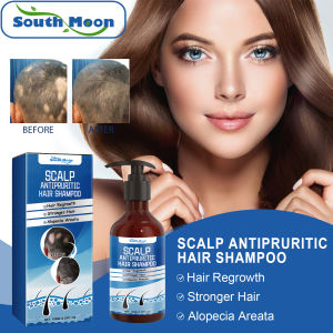 South Moon Scalp Antipruritic Hair Shampoo Rosemary Anti Itch Deeply Cleaning Scalp Remove Dandruff Shampoo Anti Dropping Repairs Dry Frizz Nourish Promote Straightener Anti Hair Loss Shampoo Oil Control Hair Growth Shampoo (100ml)