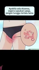 Psoriasis Cream Bai Yao Lang Cream Eczema Herbal Cream Anti-Itching Krim Gatal Kulit Herba Cina Antifungal Ubat Kurap止癢膏