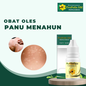 Obat Panu Menahun Obat Panu Di Wajah Obat Panu Di Punggung Obat Panu Di Selangkangan Obat Panu Murah Obat Panu Kadas Kudis Obat Jamur Kulit Panu Obat Panu Gatal Obat Penghilang Panu Membandel Penghilang Panu Di Seluruh Tubuh Dengan Propolis SM