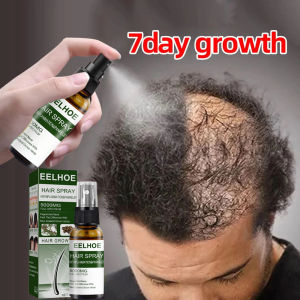 Xịt Mọc Tóc  Giảm Rụng Tóc Và Kích Thích Mọc Tóc