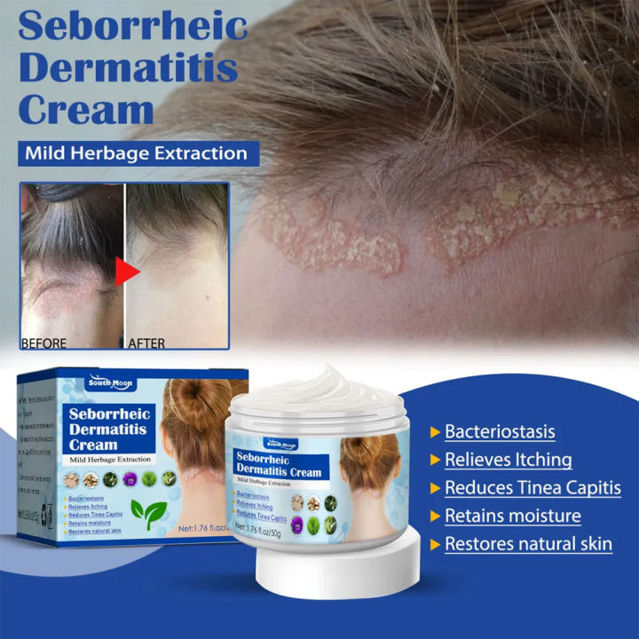 South Moon Seborrheic Dermatitis Cream 50g | Antibacterial Cream Anti ...