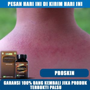 Obat Biang Keringat Obat Gatal Karna Biang Keringat Eksim Dermatitis Psoriasis Eksim Seboroik Melasma Kapalan Kusta Kurap Atasi Masalah Kulit Dengan Proskin Herbal Alami 100% Original Halal BPOM