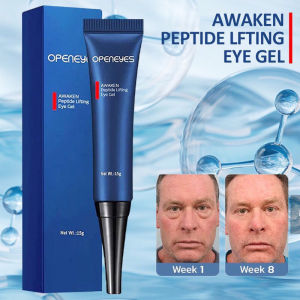 Kem xóa tan bọng mắt túi mắt thâm quầng Openeyes của Mỹ- Xoá Tan Bọng Mắt Cực Nhanh - 15g