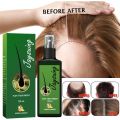 Jaysuing Green Ginger Hair Growth Spray Serum Natural Anti Hair Loss Products Fast Growing Treatments Germinal Liquid For Men Women. 