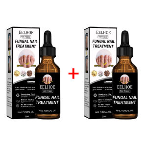 【Hot Sale】EELHOE Nail Repair Essence Toenail Fungus Treatment Liquids Paronychia Onychomycosis Anti Infection Fungal Removal Hand Foot Nail Care Onychomycosis Treatment Oil Toenail Fungus Nail Fungal Infection Removal Paronychia Repair Essence Foot Nail