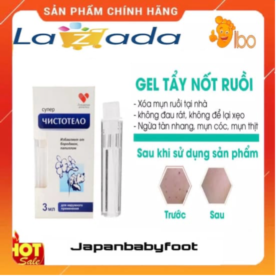 Dvelinil Nga CHÍNH HÃNG GIÁ TỐT 💥Tẩy mụn ruồi, mụn thịt, mụn cóc sẹo lồi