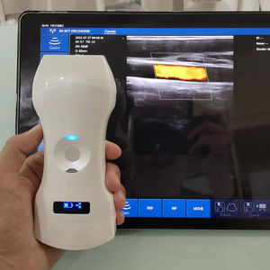 192E Wifi Wireless Color Ultrasound Doppler Convex+Linear+Phased Array 3 in 1 Support iOS Android Windows