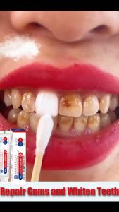【SG Stock】Whitening Toothpaste/ Gumcare/ Sensitivity Relief/ Anti-cavity/ Fresh Breath/ Stain Removal/ Fluoride-free