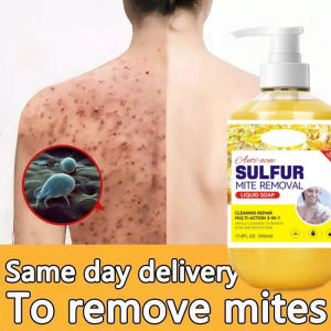 Sulphur Mite & Acne Cleansing Body Wash Antibacterial cleansing shower gel Acne body wash Suitable for All Skin
