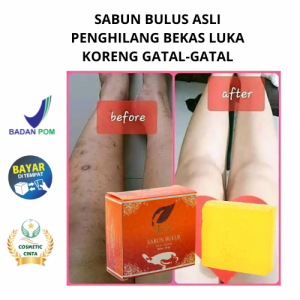 Sabun Pencerah Kulit Premium SR12 - Penghilang Bekas Luka & Koreng Perawatan Kulit Badan - Wajah ORI