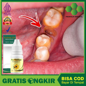 Toko Medan Obat Gigi Berlobang Obat Gigi Supaya Lepas Sendiri Obat Mudah Cabut Akar Gigi Cepat Sembuh - Propolis Sm Asli Legalitas BPOM RI dan HALAL MUI
