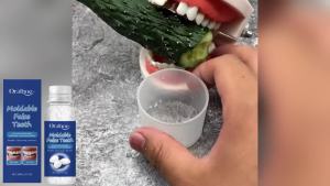 Oralhoe Solid Teeth Filler Temporary Tooth Repair Cavity Filler Denture Gap Filler Teeth Filler