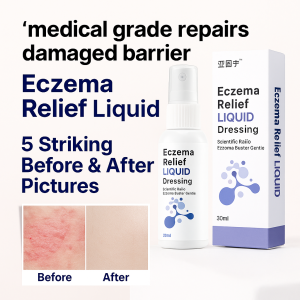 Medical Care Itching Eczema Buster Medical Dressing Treatment of Skin Problems Dermatitis Mild