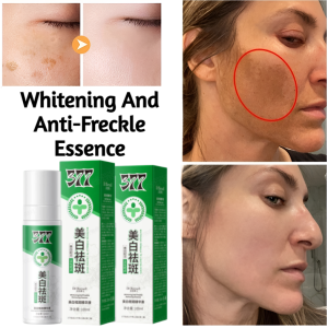 377 Whitening And Anti-Freckle Essence Brightening Skin Tone Moisturizing Improve Dark Complexion Freckle Serum 377祛斑精华