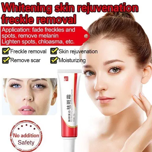 Houmai Skin Whitening Freckle Removing Cream 20g Melasma Acne Dark