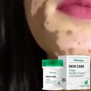 Popular Skin Pigmentation Cream - Vitiligo Solution Hydrating Easy Application Ideal for Home Care