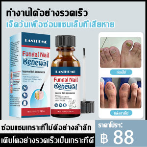 CandyRose เจลบํารุงเล็บ บำรุงเล็บ เซรั่มบำรุงเล็บ น้ํายากันเชื้อราเล็บยาหยอดเล็บเชื้อรา C09