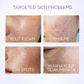SKINTIFIC Symwhite 377 Dark Spot Moisturizer Day Cream Menyamarkan Flek Hitam for Mencerahkan wajah. 