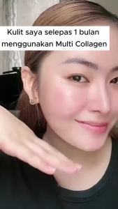 Ready Stock Multi Collagen 5X Premium Capsules 120 Capsules Premium 5 Types Hydrolyzed Collagen Protein Blend Natural Raw Material Gluten Free Dietary Supplement