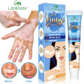 1 hari sembuh KADAI Salep Vitiligo 100% menghilangkan Menghambat Pertumbuhan Kulit Putih mengaktifkan melanin Meratakan Warna Kulit Untuk tubuh dan wajah formula jamu Tidak melukai kulit(vitiligo cream obat salep vitiligo vitiligo obat). 