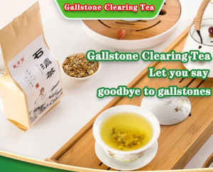 vivigo Gallstone Clearing Tea for Uroliths Gallstones Dental Calculus Health tea