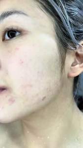 สบู่เนริสต้า Nerista Soap อ่อนโยนต่อผิว หน้ากระจ่างใสไร้สิว รอยสิวดูจางลง หน้าพังจากสารสเตียรอยด์ ของแท้100% ขนาด 30 กรัม