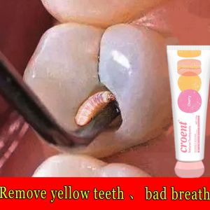 [Recommended by dentists] Quick teeth whitening toothpaste cherry fruity fresh breath toothpaste 100g remove plaque toothache bad breath coffee stains yellow black teeth calculus period inflammation yellow teeth teeth whitening toothpaste