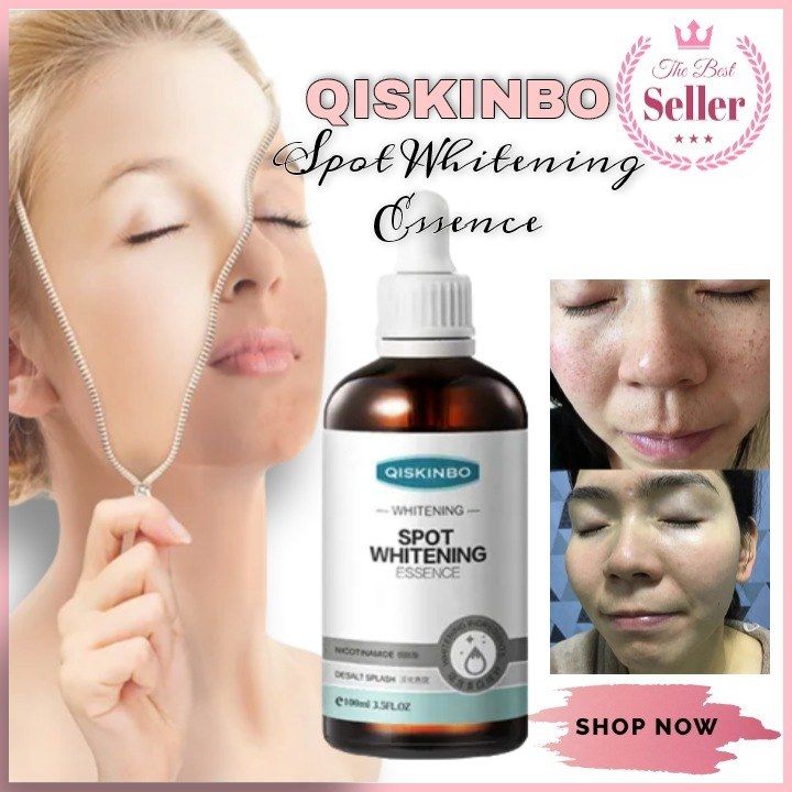 Fast whitening skin in 3 days!QISKINBO Whitening Serum Remove facial ...