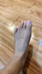 น้ำยาผิวกาย 10ml. รักแร้ หัวเข่า ข้อศอก เท้า มือ รอยดำ รอยสิวหลัง สิวหน้าอก รอยแตกลาย